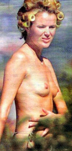 1. Amanda Holden – Topless sunbathing, 2001