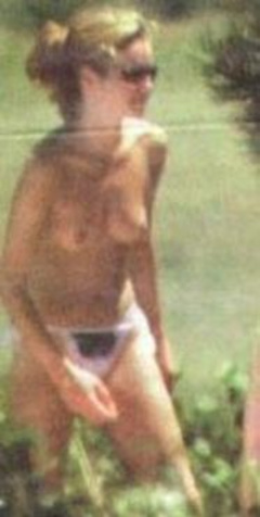 3. Amanda Holden – Topless sunbathing, 2001