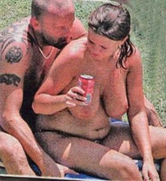 4. Kerry Katona – Topless sunbathing, 2011