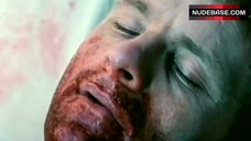 1. Lee Blakemore Exposed Tits – Blood