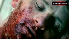 2. Lee Blakemore Exposed Tits – Blood